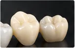 Review placeholder: ceramic crowns