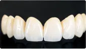 Review placeholder: dental restorations