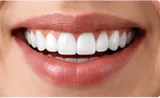 Review placeholder: finished smile
