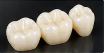 Review placeholder for Crowns & Bridges