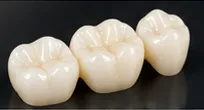 Review placeholder: crown restorations
