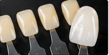 Review placeholder for Shade Matching & Esthetic Work